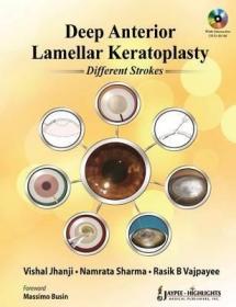 现货 Deep Anterior Lamellar Keratoplasty: Different Strokes[9789350256329]