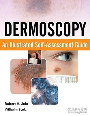 现货 Dermoscopy: An Illustrated Self-Assessment Guide[9780071613552]