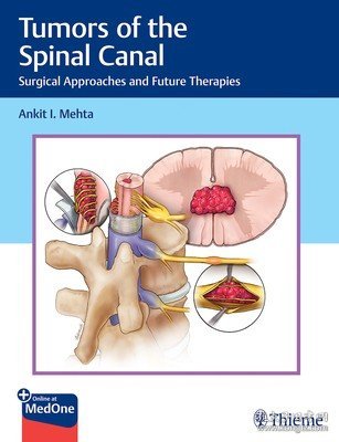 现货Tumors of the Spinal Canal: Surgical Approaches and Future Therapies[9781626239319]