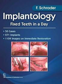 现货Implantology: Fixed Teeth in a Day[9789385915918]