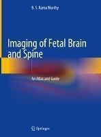 现货 Imaging of Fetal Brain and Spine: An Atlas and Guide (2019)[9789811358432]