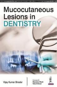 现货 Mucocutaneous Lesions in Dentistry[9789352500406]