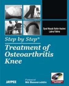 现货 Treatment Of Osteoarthritis Knee [9789380704838]