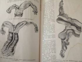 百年老书! LEHRBUCH  DER  GYNÄKOLOGIE 妇科教科书(1923年德文原版书,小16开布面硬精装,大量插图\套色插图\彩色插图)