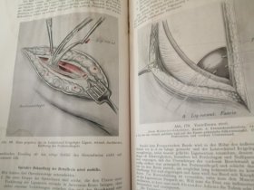 百年老书! LEHRBUCH  DER  GYNÄKOLOGIE 妇科教科书(1923年德文原版书,小16开布面硬精装,大量插图\套色插图\彩色插图)