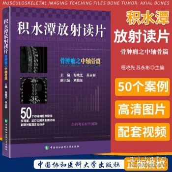 积水潭放射读片——骨肿瘤之中轴骨篇