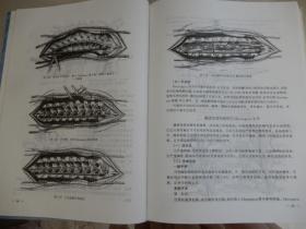 脊柱外科手术图谱