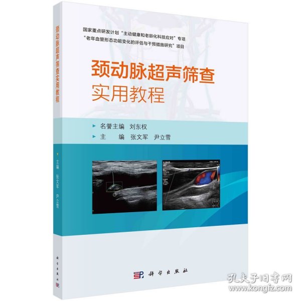 颈动脉超声筛查实用教程