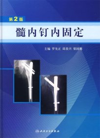 髓内钉内固定（第2版）
