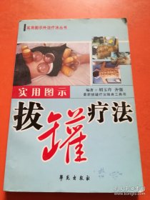 实用图示拔罐疗法