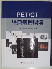 PET/CT 经典病例图谱