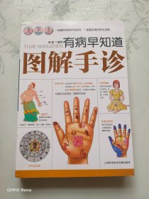 有病早知道：图解手诊