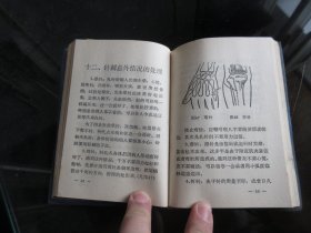 罕见1968年初版《快速针刺疗法》内有毛主席像、林副主席题词-尊E-4