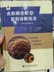 皮肤病诊断与鉴别诊断技法：透过皮疹看全身