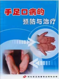 手足口病的预防与治疗 VCD 光盘 视频 适用于各级各类机构医务工作特别是传染科医生学习