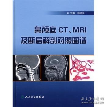 鼻颅底CT、MRI及断层解剖对照图谱