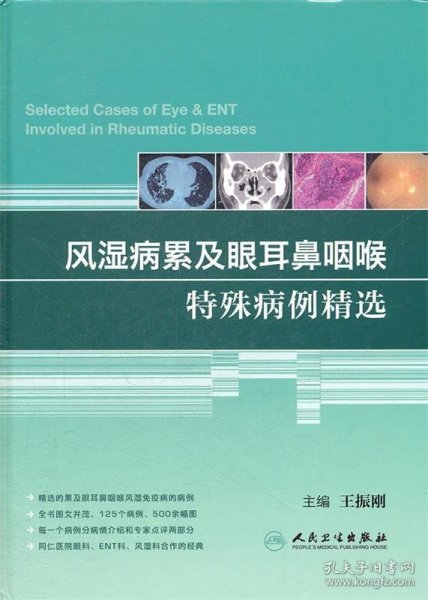 风湿病累及眼耳鼻咽喉特殊病例精选