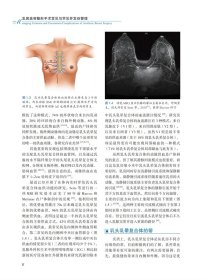 乳房美容整形手术常见与罕见并发症管理 9787523202951 李永平