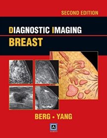 Diagnostic Imaging: Breast, 2nd ed