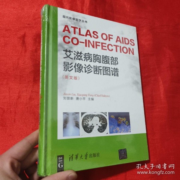 艾滋病胸腹部影像诊断图谱 （ ATLAS OF AIDS CO-INFECTION）（英文版）