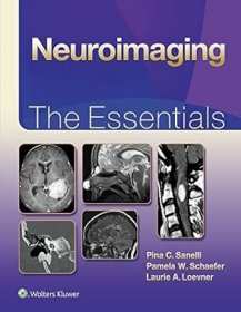 Neuroimaging: The Essentials