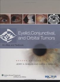 Eyelid, Conjunctival, and Orbital Tumors: An Atlas and Text