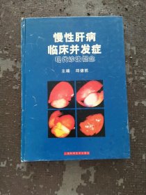 慢性肝病 临床并发症 书外有划痕不影响阅读