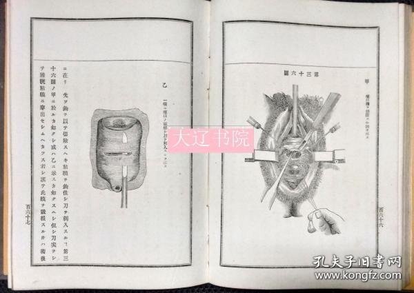 简明妇人病论 1880年 6册