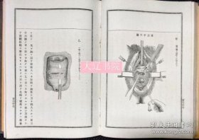 简明妇人病论 1880年 6册