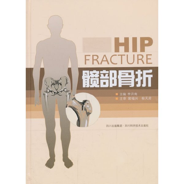 髋部骨折