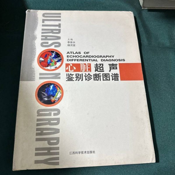 心脏超声鉴别诊断图谱