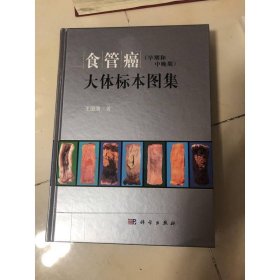 食管癌（早期和中晚期）大体标本图集