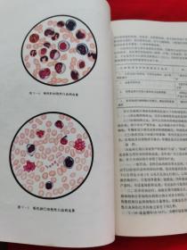 内科学：军医试用教材  （前带毛主席语录。有图例，有中药方，16开本，481页， 1973年一版一印）