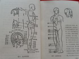 实用针灸——赤脚医生丛书（老版医学书，馆藏本，有一枚章。前有毛主席语录，多种空位针图，大厚册，836页，1975年一版一印，）