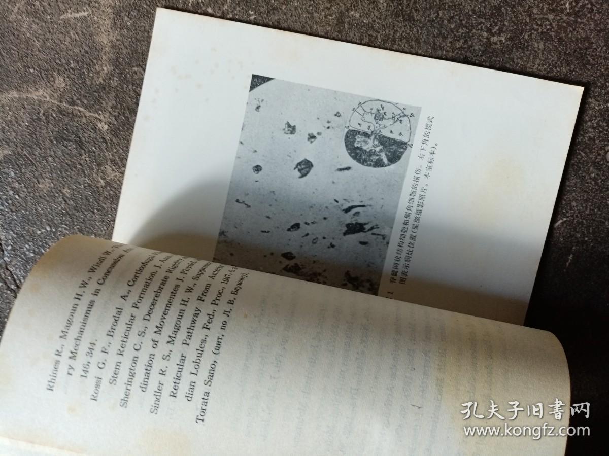 中枢神经系统网状结构临床学和病理形态学概论