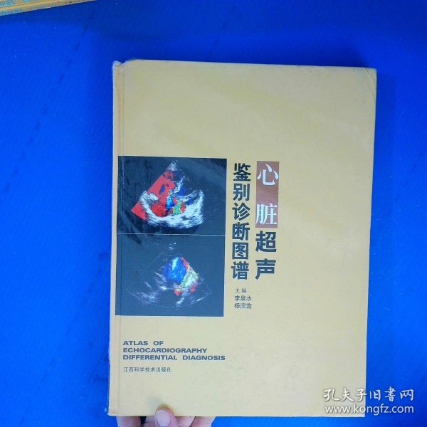 心脏超声鉴别诊断图谱