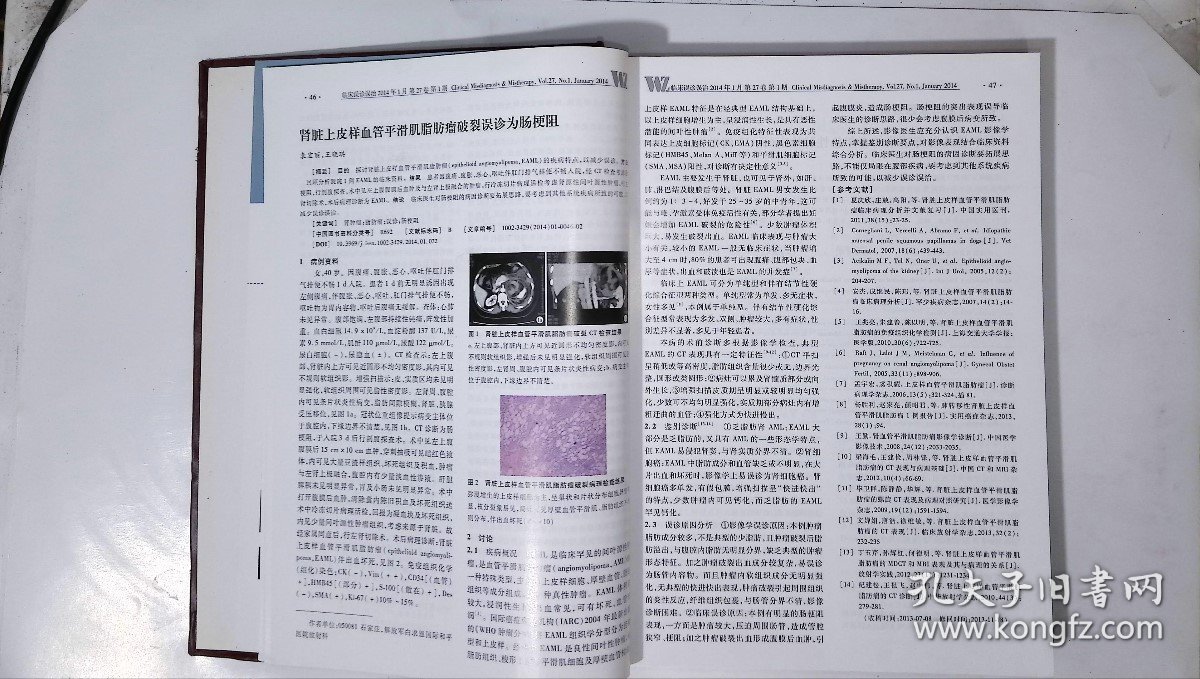 临床误诊误治，期数：1-6，cwg_wwqk_1