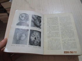 农村医生手册 人民卫生出版社   品如图  31-3号柜