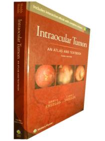 英文原版       Intraocular Tumors: An Atlas and Textbook     眼内肿瘤：地图集和教科书