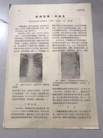 1978年《推拿针刺治疗肱骨外上踝炎介绍-张德林、梁振安》（中医资料）。