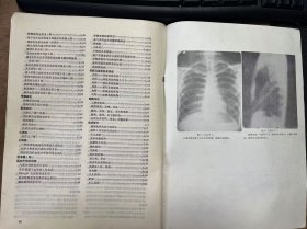 《基层医刊 1983 6》（第三卷） 郭美香：真菌性角膜溃疡的诊断和治疗/李奋扬：警惕孕妇肺结核恶化(附5例报告)/梅炳勋等：基层医院对肾动脉狭窄诊断和手术治疗的体会/孙晓春：潘生丁治疗新生儿硬肿症的疗效观察/蔡兆文 汪婉琛：成年人风湿性心瓣膜病诊断与治疗问题/内科——血液系统疾病(一)/王健平：四肢软组织金属小异物简易定位法/朱搏浪 孔庆彩：卡那霉素灌肠治疗难治性急性茵痢 ......