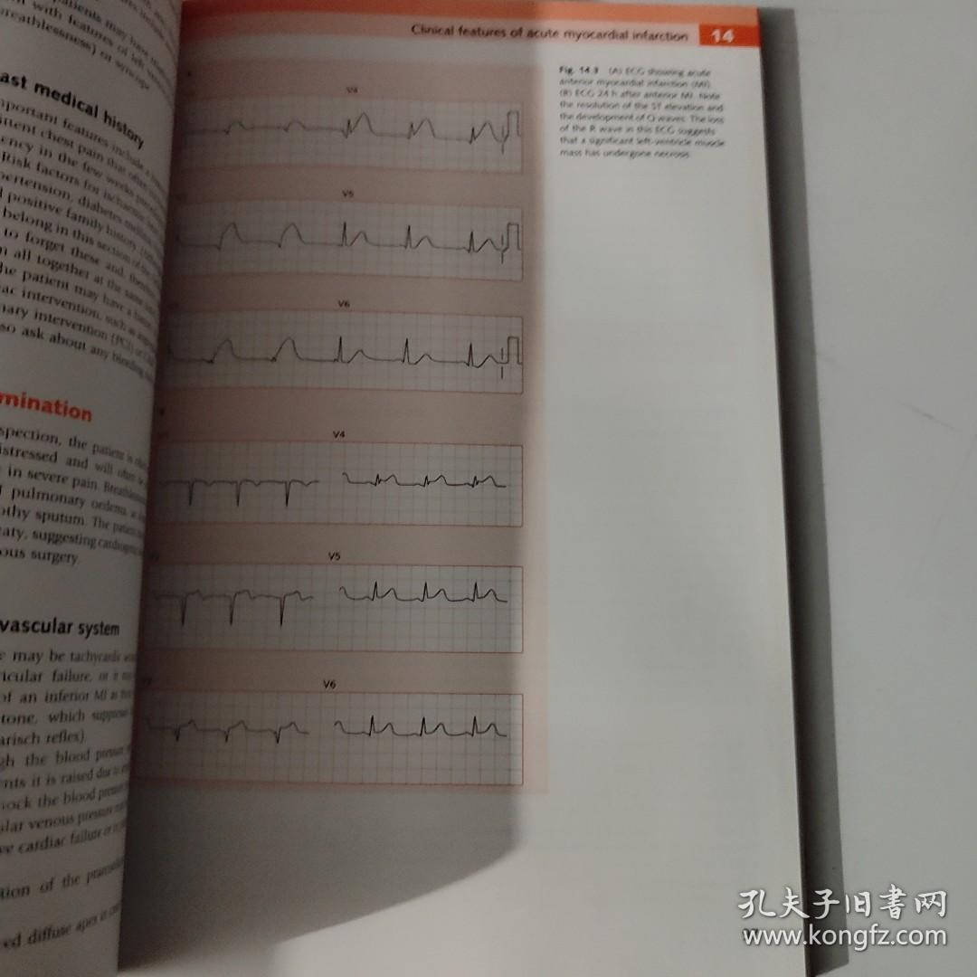 CRASH COURSE Cardiology 4TH EDITION 速成课程心脏病学第四版