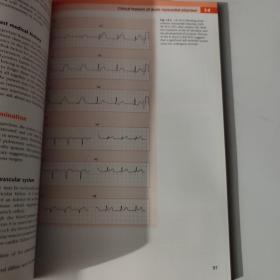 CRASH COURSE Cardiology 4TH EDITION 速成课程心脏病学第四版