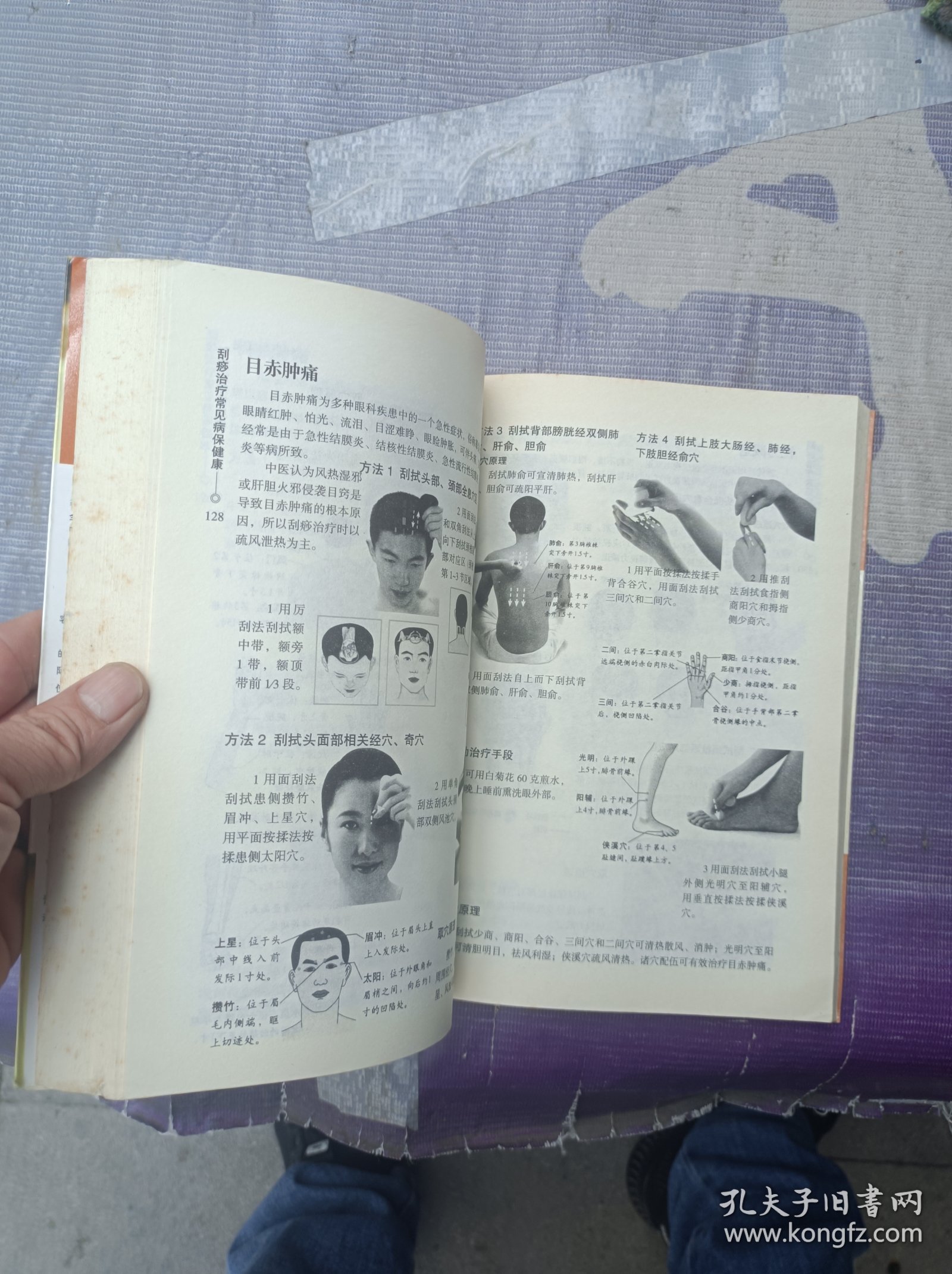 张秀勤刮痧