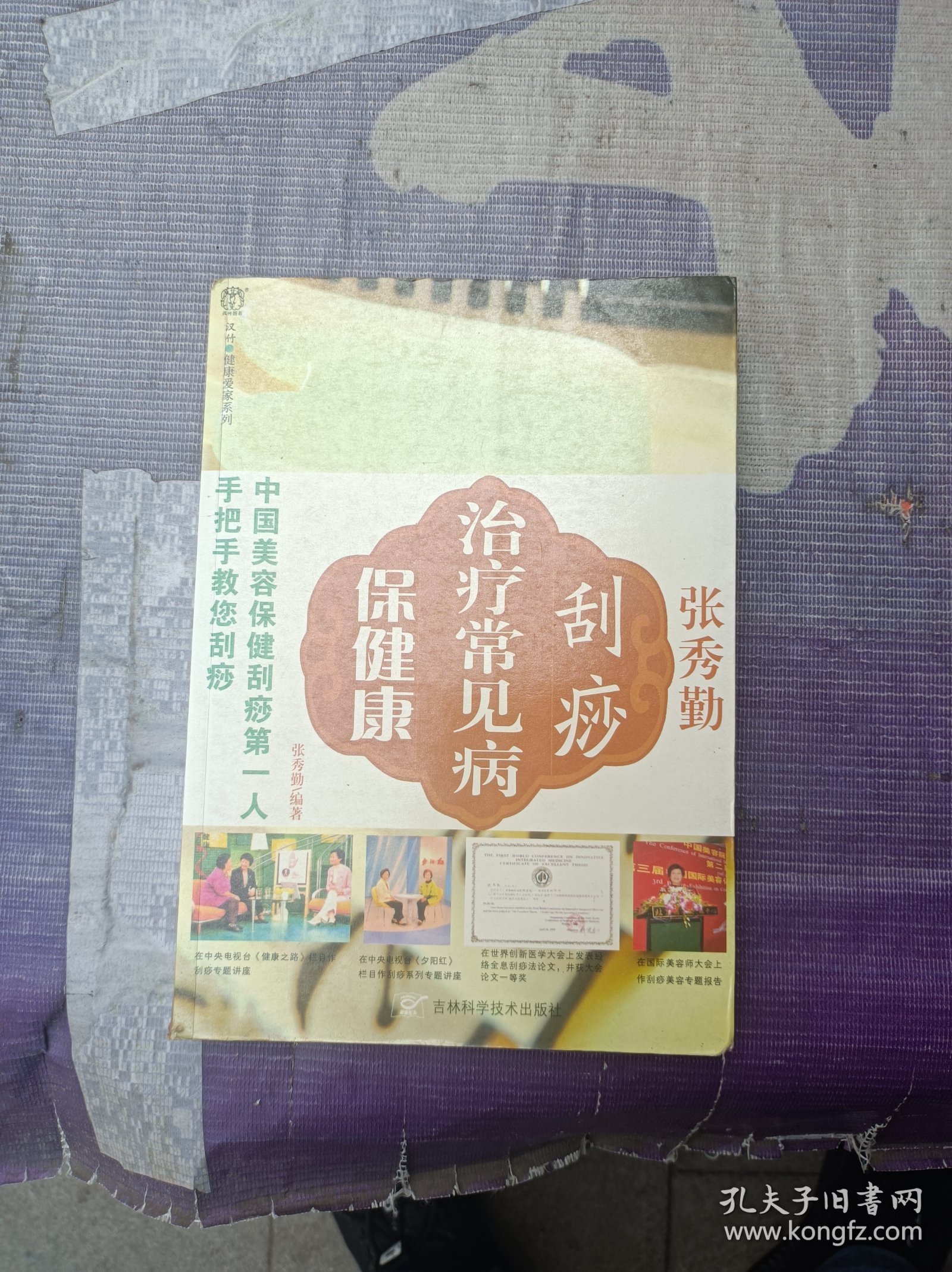 张秀勤刮痧