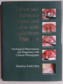 婴儿与儿童的咽喉及皮肤感染性疾病的病毒学观察与临床照片诊断