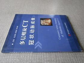 多层螺旋CT冠状动脉成像