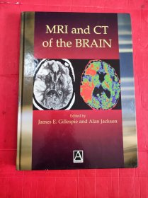 MRI and CT of the BRAIN