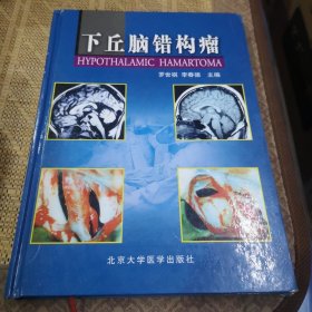 下丘腦錯(cuò)構(gòu)瘤