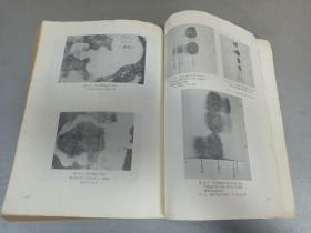 W   1976年  山西卫生出版社出版   中山医学院编写组编   《内科疾病鉴别诊断学》  一册全！！！